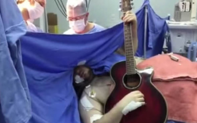 YouTube sorprende con la imagen de un brasileño de 33 años que toca la guitarra mientras un conjunto de cirujanos le retira un tumor del cerebro.